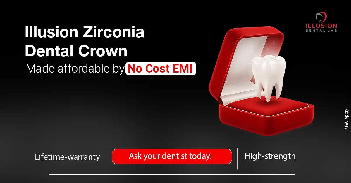 popup banner